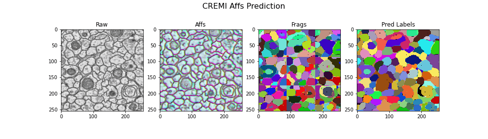 cremi-prediction